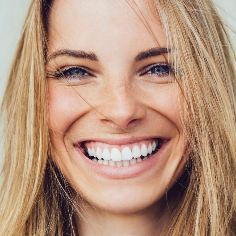 How Much Do Veneers Cost