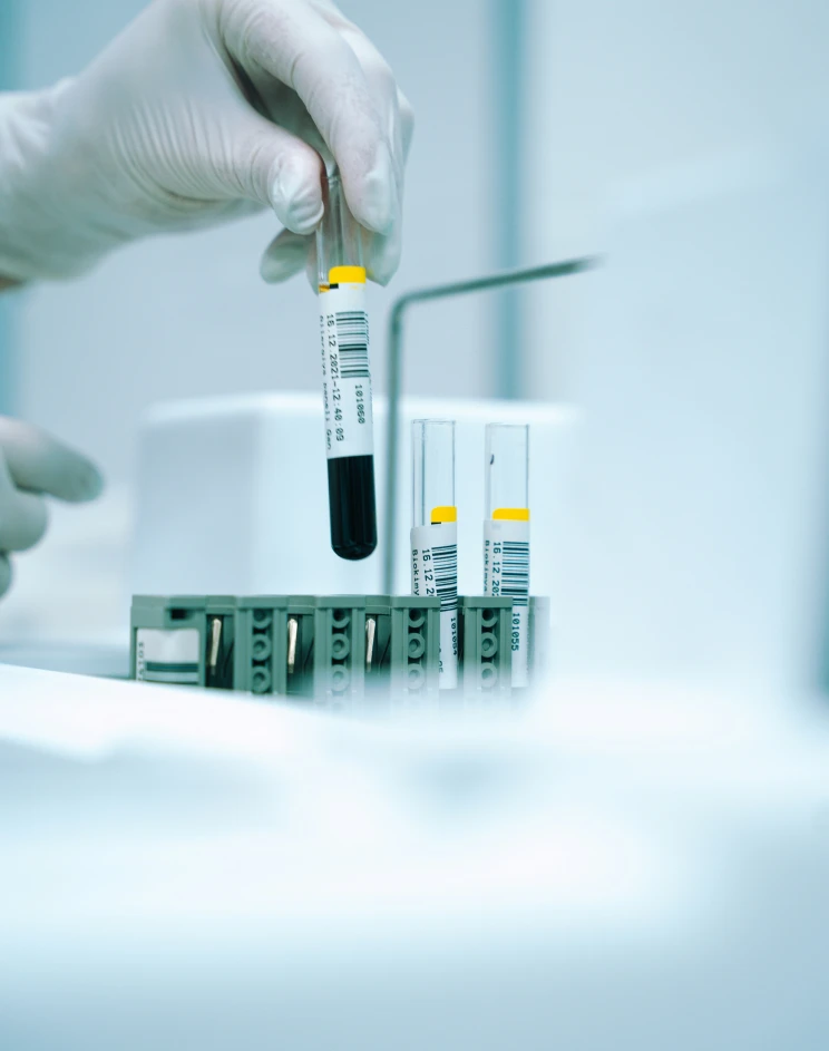 Epigenetic Aging Tests Price